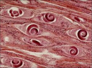 Trichinella spiralis en musculos