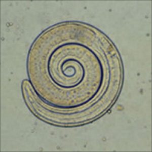 Trichinella spiralis