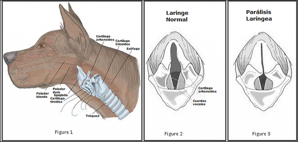 Parálisis laringea