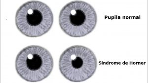Síndrome de Horner en el Perro