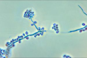 Esporotricosis en Perros y Gatos