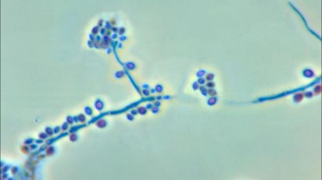 Esporotricosis en Perros y Gatos